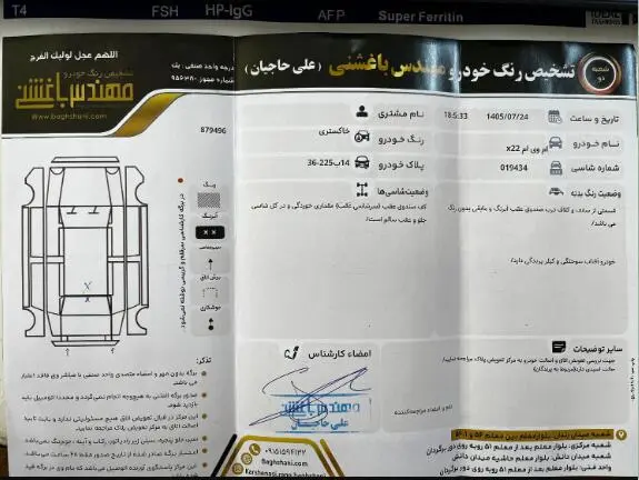 ام وی ام،  X22