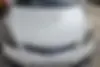 ام وی ام،  315هاچ بک