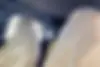 روئوه  eRX5
