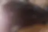 فولکس،  گل